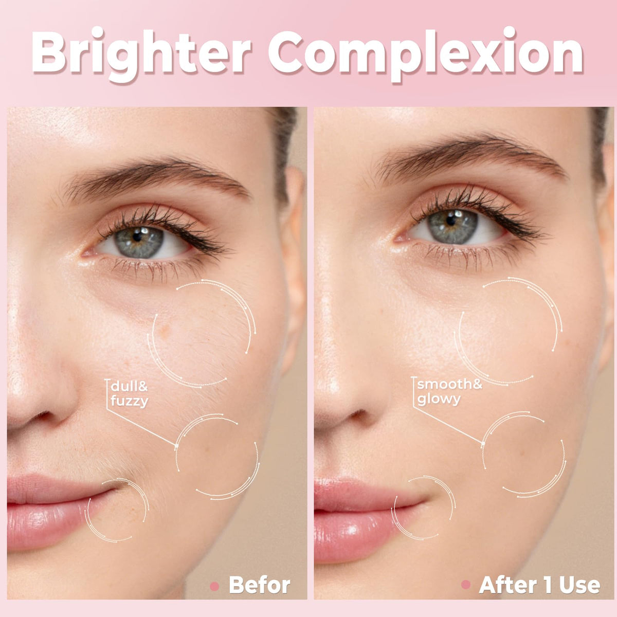 White Rechargeable Dermaplane Razor with 3 Replacement Blades B20443